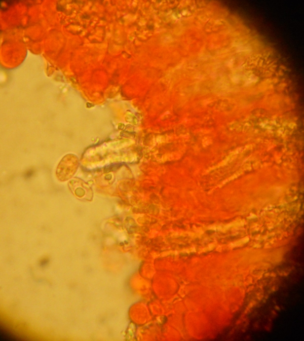 da determinare (Hyphodermella corrugata)